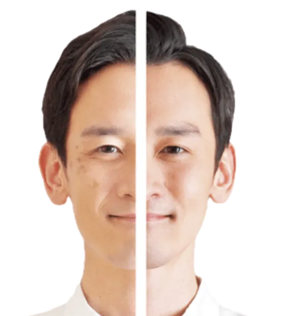 光フェイシャル メンズフェイスケア