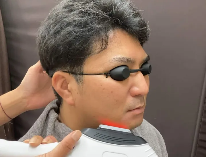 40代 光フェイシャル 美容 照射